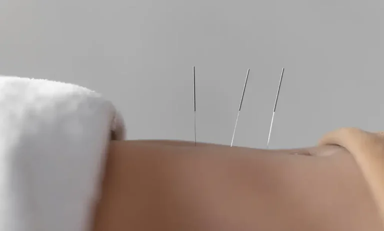 Chinese acupuncture treatment