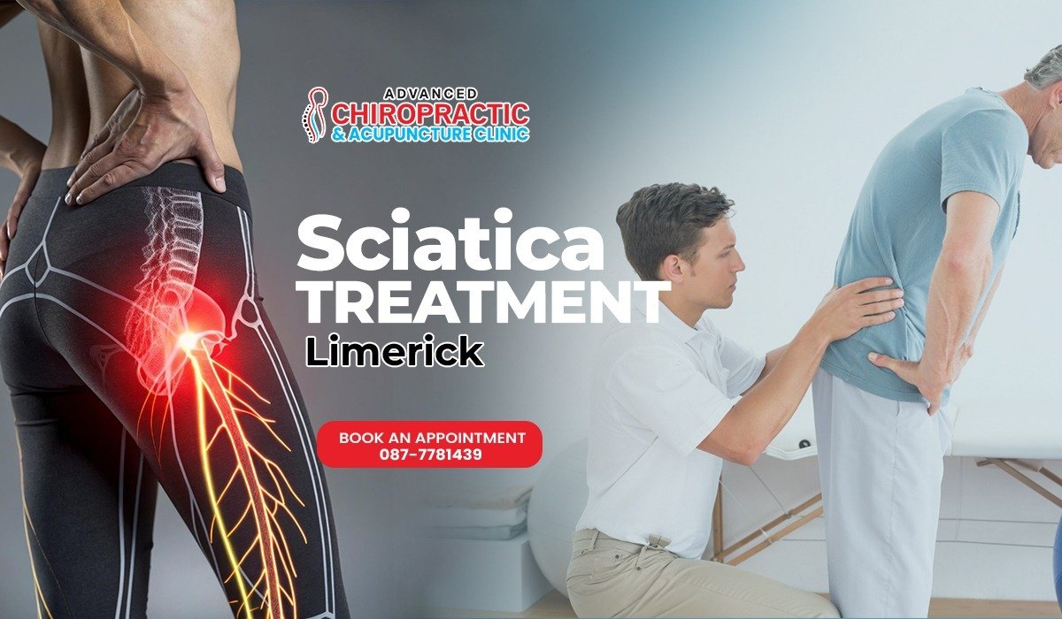 Sciatica treatment Limerick